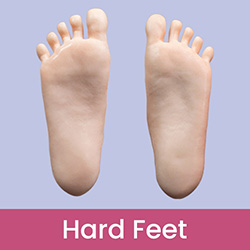 Hard Feet(Without Bolts)