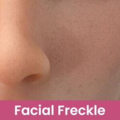 SEDoll-Other Options-Facial Freckle