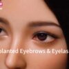Cejas y pestañas implantadas