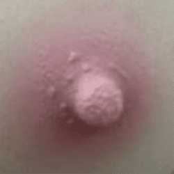 No.1
