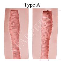 #A