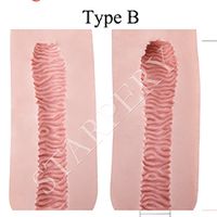#B